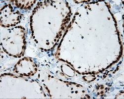 BAP / SIL1 Antibody - Immunohistochemical staining of paraffin-embedded thyroid tissue using anti-SIL1 mouse monoclonal antibody. (Dilution 1:50).