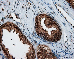 BAP / SIL1 Antibody - Immunohistochemical staining of paraffin-embedded prostate tissue using anti-SIL1 mouse monoclonal antibody. (Dilution 1:50).