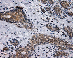 BAP / SIL1 Antibody - Immunohistochemical staining of paraffin-embedded breast tissue using anti-SIL1 mouse monoclonal antibody. (Dilution 1:50).
