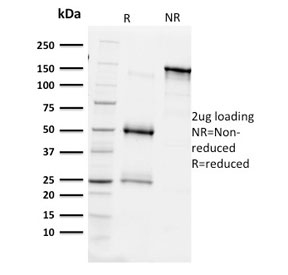 BAP1 Antibody - SDS-PAGE analysis of purified, BSA-free BAP1 antibody (clone BAP1/2431) as confirmation of integrity and purity.