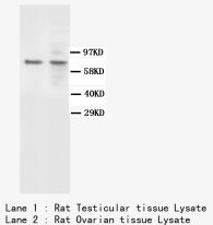 BAP1 Antibody -  This image was taken for the unconjugated form of this product. Other forms have not been tested.