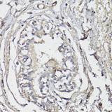 BAP1 Antibody - Immunohistochemistry of paraffin-embedded Human breast using BAP1 Polyclonal Antibody at dilution of 1:150 (40x lens).