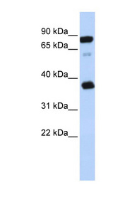 BAP29 / BCAP29 Antibody - BCAP29 / BAP29 antibody Western blot of Jurkat lysate. This image was taken for the unconjugated form of this product. Other forms have not been tested.