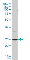 BAP29 / BCAP29 Antibody - BCAP29 monoclonal antibody (M07), clone 4B10 Western blot of BCAP29 expression in PC-12.