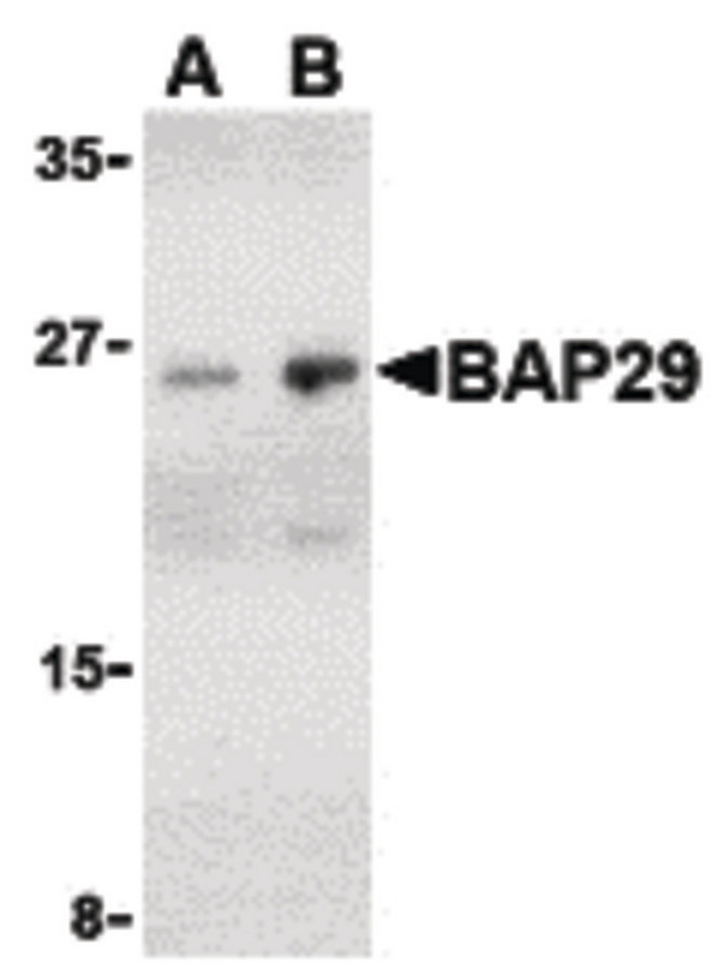 BAP29 / BCAP29 Antibody - Western blot of Bap29 in human heart tissue lysate with Bap29 antibody at (A) 1 and (B) 2 ug/ml.
