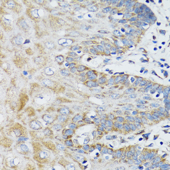 BAP29 / BCAP29 Antibody - Immunohistochemistry of paraffin-embedded human prostate tissue.