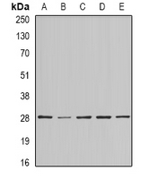 BAP29 / BCAP29 Antibody - Western blot analysis of BAP29 expression in SKOV3 (A); MCF7 (B); mouse testis (C); mouse brain (D); rat heart (E) whole cell lysates.