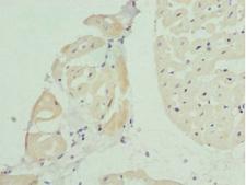 BAP29 / BCAP29 Antibody - Immunohistochemistry of paraffin-embedded human heart tissue at dilution 1:100