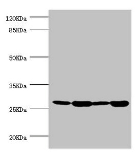 BAP29 / BCAP29 Antibody - Western blot All Lanes:BCAP29 antibody at 2.93ug/ml Lane 1:Raji whole cell lysate Lane 2:Colo320 whole cell lysate Lane 3:rat gonad tissue Lane 4:THP-1 whole cell lysate Secondary Goat polyclonal to rabbit at 1/10000 dilution Predicted band size: 29,41 kDa Observed band size: 28 kDa