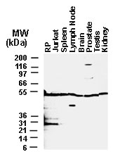 BAR / BFAR Antibody - Western blot of BAR in cell lines and tissues. 25 ug of total protein was loaded per lane. BAR Recombinant protein (RP) was used as a positive control.