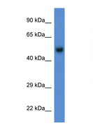 BAR / BFAR Antibody - BFAR antibody Western blot of Mouse Brain lysate. Antibody concentration 1 ug/ml. This image was taken for the unconjugated form of this product. Other forms have not been tested.