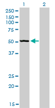 BAR / BFAR Antibody - Western blot of BFAR expression in transfected 293T cell line by BFAR monoclonal antibody (M01), clone 1C6.