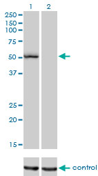 BAR / BFAR Antibody - Western blot of BFAR over-expressed 293 cell line, cotransfected with BFAR Validated Chimera RNAi (Lane 2) or non-transfected control (Lane 1). Blot probed with BFAR monoclonal antibody, clone 1C6. GAPDH ( 36.1 kD ) used as specificity an.