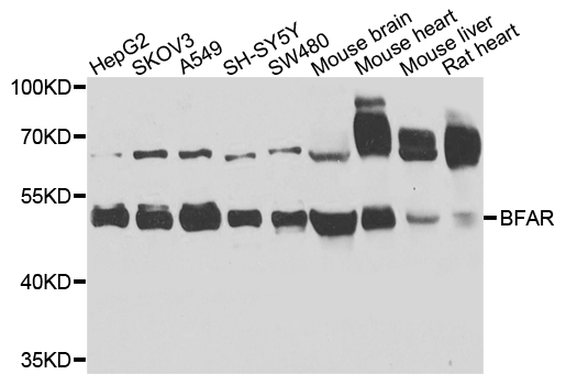 BAR / BFAR Antibody - Western blot analysis of extracts of various cells.