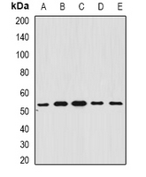 BAR / BFAR Antibody - Western blot analysis of BAR expression in A549 (A); SHSY5Y (B); mouse brain (C); mouse liver (D); rat heart (E) whole cell lysates.