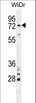 BARD1 Antibody - BARD1 Antibody western blot of WiDr cell line lysates (35 ug/lane). The BARD1 antibody detected the BARD1 protein (arrow).