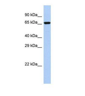 BARD1 Antibody - Western blot of Human MCF7. BARD1 antibody dilution 1.0 ug/ml.  This image was taken for the unconjugated form of this product. Other forms have not been tested.