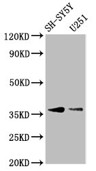 BARHL1 Antibody - Western Blot Positive WB detected in: SH-SY5Y whole cell lysate, U251 whole cell lysate All Lanes: BARHL1 antibody at 3.4µg/ml Secondary Goat polyclonal to rabbit IgG at 1/50000 dilution Predicted band size: 36 KDa Observed band size: 36 KDa