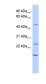 BARHL2 Antibody - BARHL2 antibody Western blot of HepG2 cell lysate. This image was taken for the unconjugated form of this product. Other forms have not been tested.