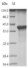 LIAS / LIP1 Protein - (Tris-Glycine gel) Discontinuous SDS-PAGE (reduced) with 5% enrichment gel and 15% separation gel.