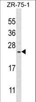 BARX1 Antibody - BarX1 Antibody western blot of ZR-75-1 cell line lysates (35 ug/lane). The BarX1 antibody detected the BarX1 protein (arrow).