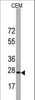BARX1 Antibody - Western blot of BarX1 Antibody in CEM cell line lysates (35 ug/lane). BarX1(arrow) was detected using the purified antibody.