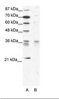 BARX1 Antibody - A: Marker, B: Jurkat Cell Lysate.  This image was taken for the unconjugated form of this product. Other forms have not been tested.