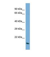 BARX2 Antibody - Western blot of Human HepG2. BARX2 antibody dilution 1.0 ug/ml.  This image was taken for the unconjugated form of this product. Other forms have not been tested.