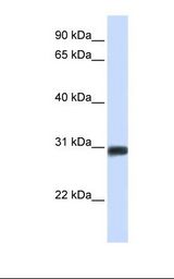 BARX2 Antibody - Fetal muscle lysate. Antibody concentration: 1.0 ug/ml. Gel concentration: 12%.  This image was taken for the unconjugated form of this product. Other forms have not been tested.