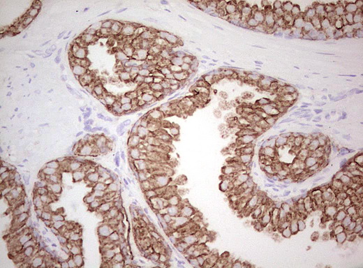 Basic Cytokeratin AE3 Antibody - Immunohistochemical staining of paraffin-embedded Human prostate tissue within the normal limits using anti-Acidic Cytokeratin mouse monoclonal antibody. (Heat-induced epitope retrieval by Tris-EDTA, pH8.0)