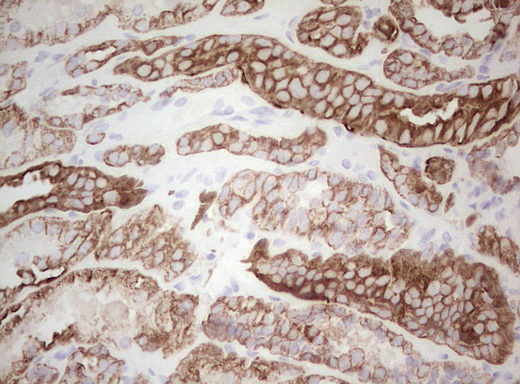 Basic Cytokeratin AE3 Antibody - Immunohistochemical staining of paraffin-embedded Human Kidney tissue within the normal limits using anti-Acidic Cytokeratin mouse monoclonal antibody. (Heat-induced epitope retrieval by Tris-EDTA, pH8.0)