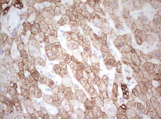 Basic Cytokeratin AE3 Antibody - IHC of paraffin-embedded Human liver tissue using anti-Acidic Cytokeratin mouse monoclonal antibody. (Heat-induced epitope retrieval by Tris-EDTA, pH8.0).