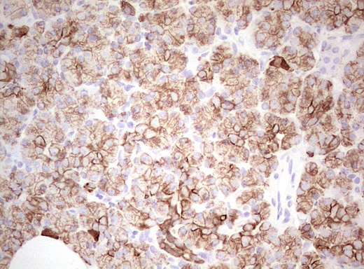 Basic Cytokeratin AE3 Antibody - IHC of paraffin-embedded Human pancreas tissue using anti-Acidic Cytokeratin mouse monoclonal antibody. (Heat-induced epitope retrieval by Tris-EDTA, pH8.0).