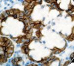 Basic Cytokeratin AE3 Antibody - IHC of CK HMW/ÁE3 on FFPE Salivary Gland tissue. This image was taken for the unmodified form of this product. Other forms have not been tested.