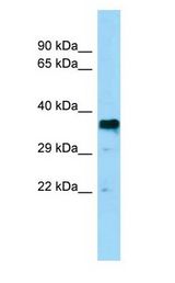 Basigin / Emmprin / CD147 Antibody - Basigin / Emmprin / CD147 antibody Western Blot of 721_B.  This image was taken for the unconjugated form of this product. Other forms have not been tested.
