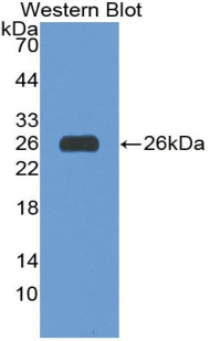 Basigin / Emmprin / CD147 Antibody - Western blot of Basigin / Emmprin / CD147 antibody.