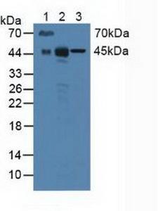 Basigin / Emmprin / CD147 Antibody - Western Blot; Sample: Lane1: Mouse Serum; Lane2: Mouse Liver Tissue; Lane3: Human Hela Cells.