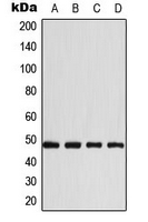Basigin / Emmprin / CD147 Antibody - Western blot analysis of CD147 expression in A431 (A); HeLa (B); Raw264.7 (C); mouse heart (D) whole cell lysates.