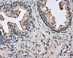 Basigin / Emmprin / CD147 Antibody - IHC of paraffin-embedded Human prostate tissue using anti-BSG mouse monoclonal antibody.