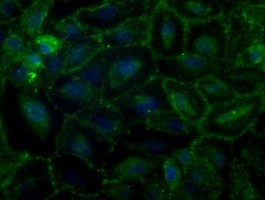 Basigin / Emmprin / CD147 Antibody - Immunofluorescent staining of A549 cells using anti-BSG mouse monoclonal antibody.