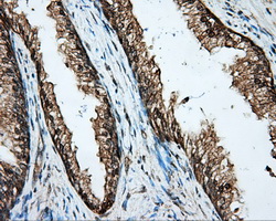 Basigin / Emmprin / CD147 Antibody - IHC of paraffin-embedded prostate tissue using anti-BSG mouse monoclonal antibody. (Dilution 1:50).