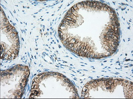 Basigin / Emmprin / CD147 Antibody - IHC of paraffin-embedded Human prostate tissue using anti-BSG mouse monoclonal antibody. (Dilution 1:50).