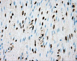 Basigin / Emmprin / CD147 Antibody - IHC of paraffin-embedded Human colon tissue using anti-BSG mouse monoclonal antibody.