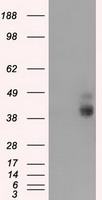 Basigin / Emmprin / CD147 Antibody - HEK293T cells were transfected with the pCMV6-ENTRY control (Left lane) or pCMV6-ENTRY BSG (Right lane) cDNA for 48 hrs and lysed. Equivalent amounts of cell lysates (5 ug per lane) were separated by SDS-PAGE and immunoblotted with anti-BSG.