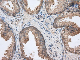 Basigin / Emmprin / CD147 Antibody - Immunohistochemical staining of paraffin-embedded Human prostate tissue using anti-BSG mouse monoclonal antibody. (Dilution 1:50).