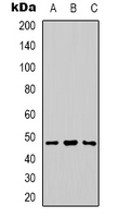 Basigin / Emmprin / CD147 Antibody - Western blot analysis of CD147 expression in HepG2 (A); Jurkat (B); PC12 (C) whole cell lysates.