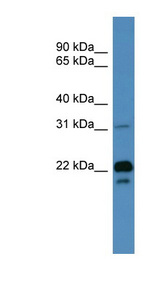 BASP1 Antibody - BASP1 antibody Western blot of Fetal Muscle lysate.  This image was taken for the unconjugated form of this product. Other forms have not been tested.