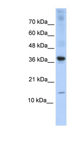 BATF Antibody - BATF antibody Western blot of Transfected 293T cell lysate. This image was taken for the unconjugated form of this product. Other forms have not been tested.