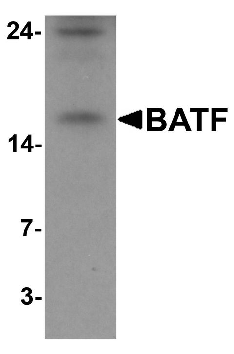 BATF Antibody - Western blot analysis of BATF in rat spleen tissue lysate with BATF antibody at 1 ug/ml.