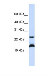 BATF Antibody - Jurkat cell lysate. Antibody concentration: 1.0 ug/ml. Gel concentration: 10-20%.  This image was taken for the unconjugated form of this product. Other forms have not been tested.